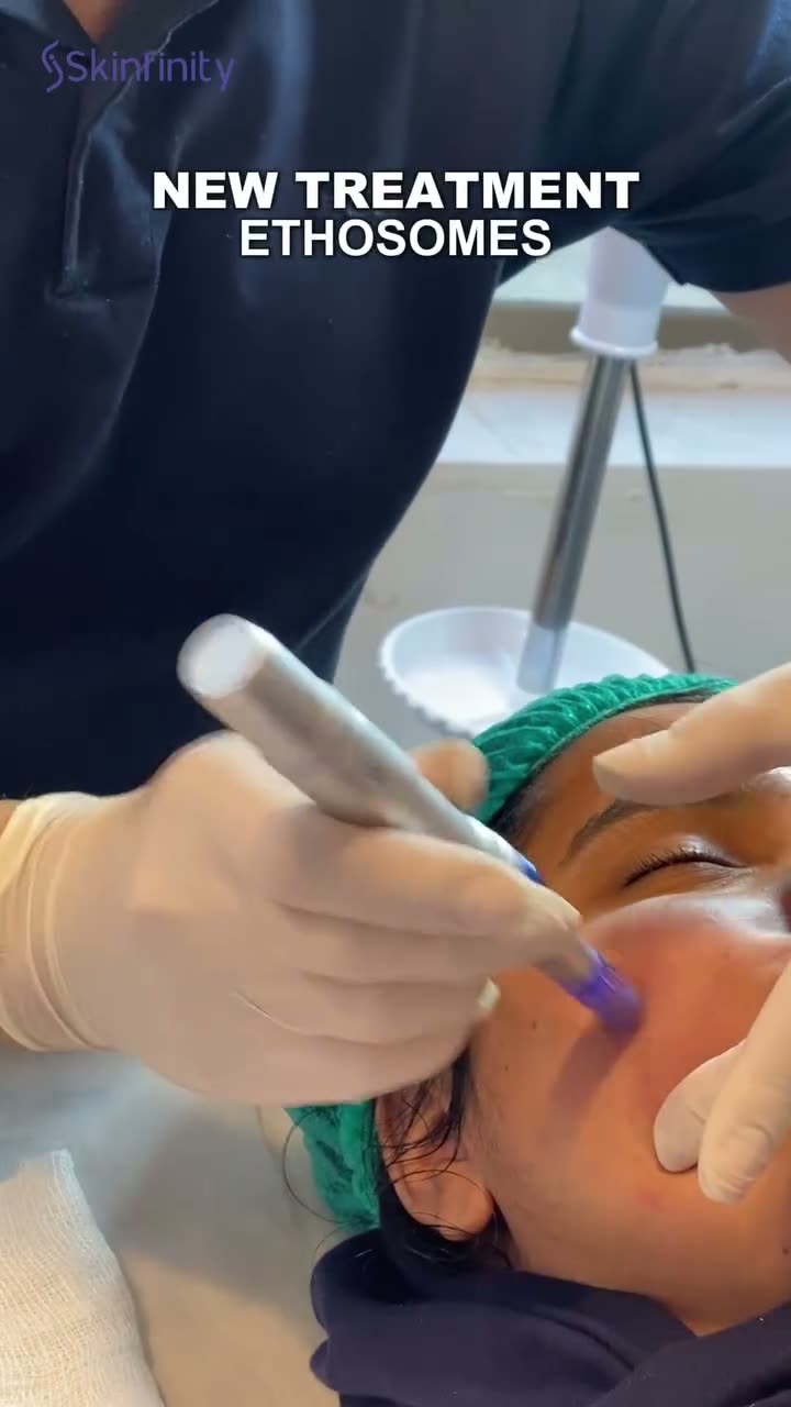 Ethosomes treatment being performed by a Skinfinity practitioner