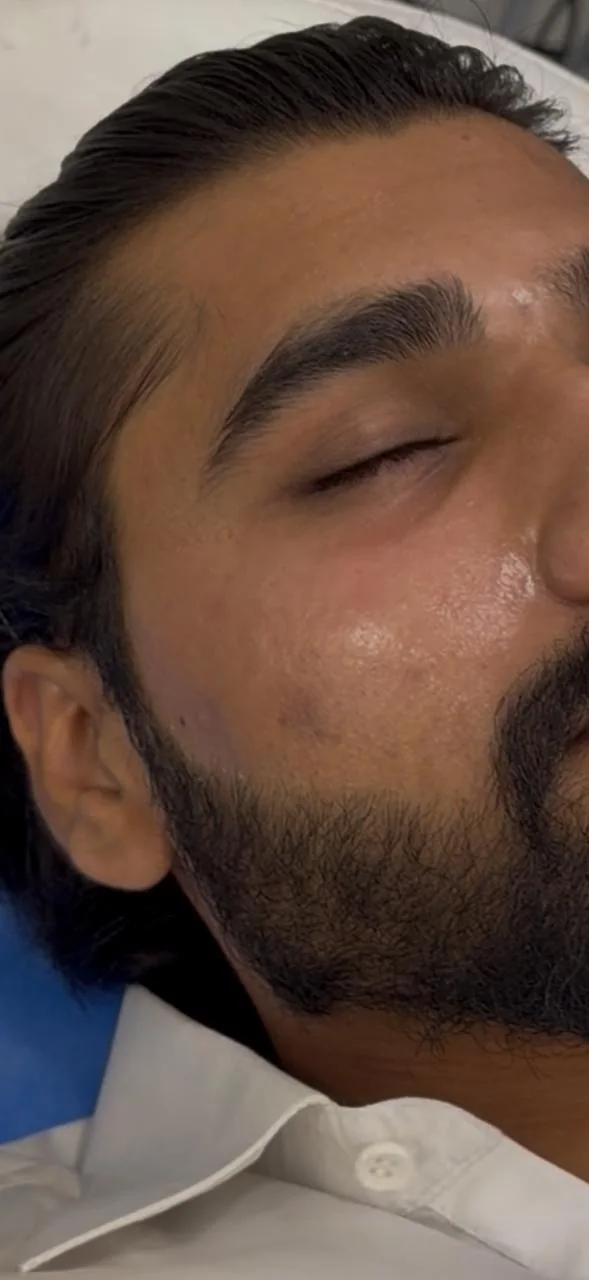Client during an in-clinic skin treatment